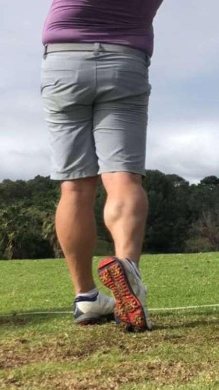 Close view of a calf muscle, which can lock in a sustained and painful contraction during a cramp