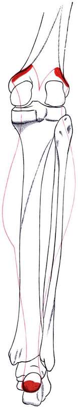 Anatomical illustration of the calf muscles, where most leg cramps strike