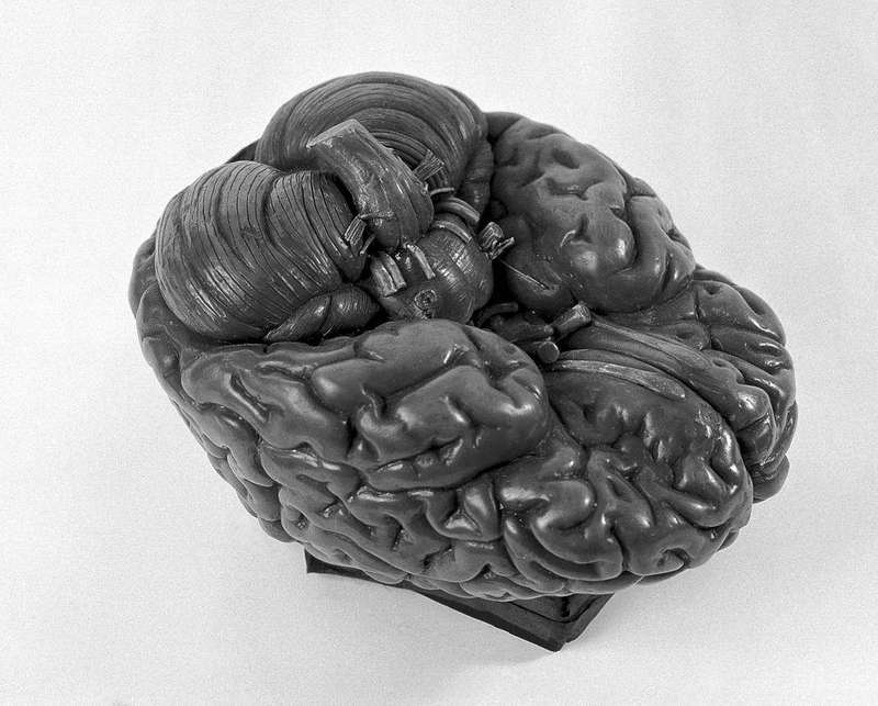 Anatomical model of a human brain