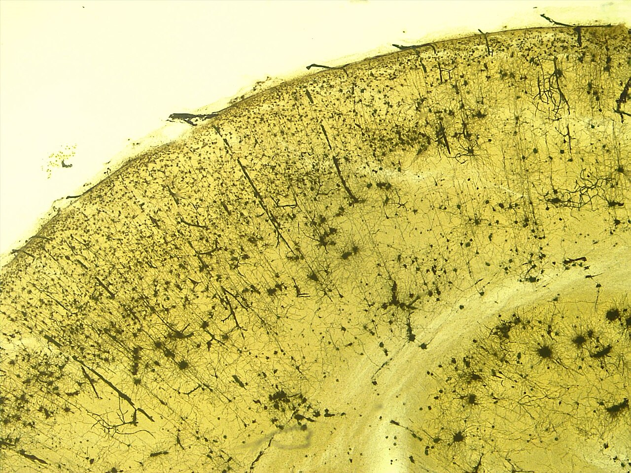 Stained cortical neurons viewed under a microscope