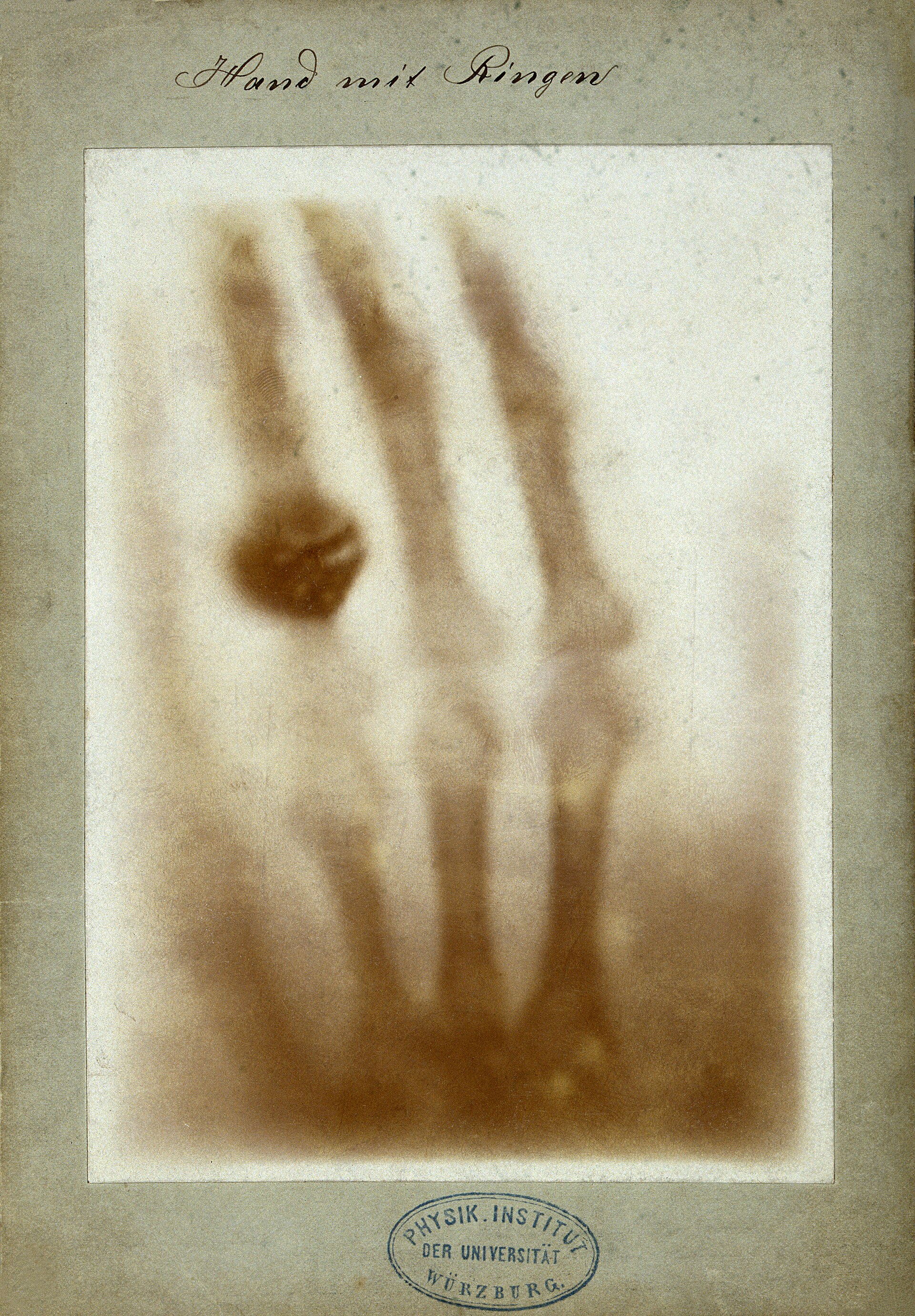 The first medical X-ray, showing the bones of a hand