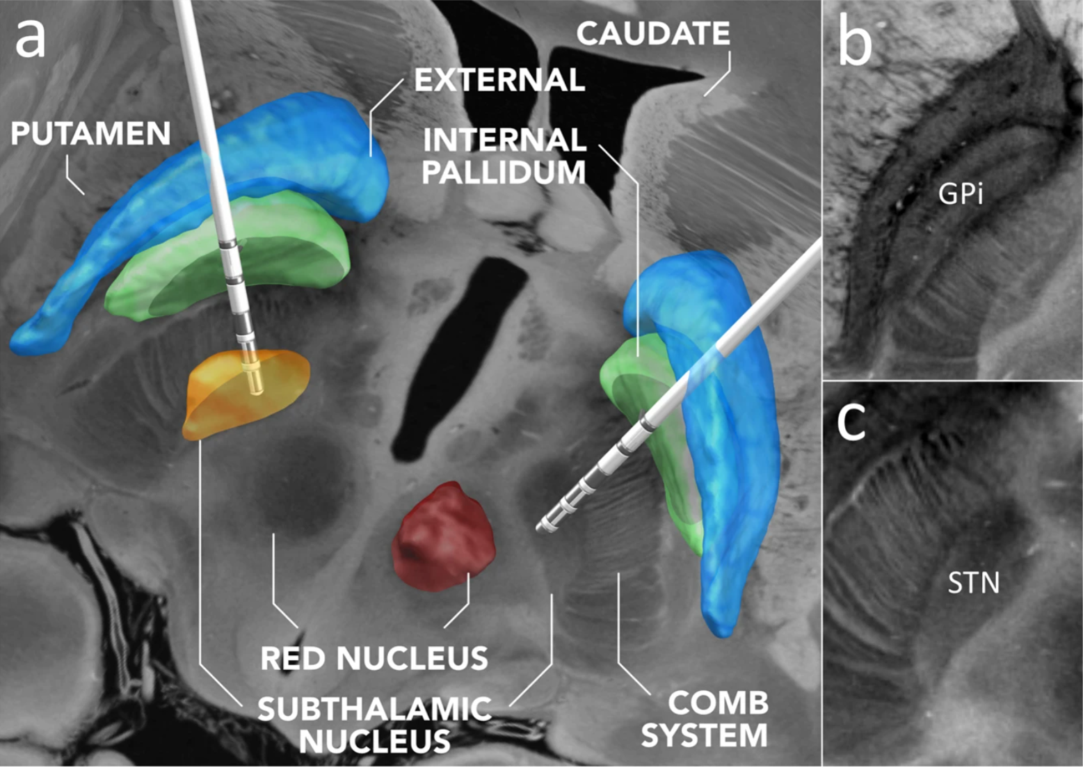 A high-resolution MRI scan of a human brain