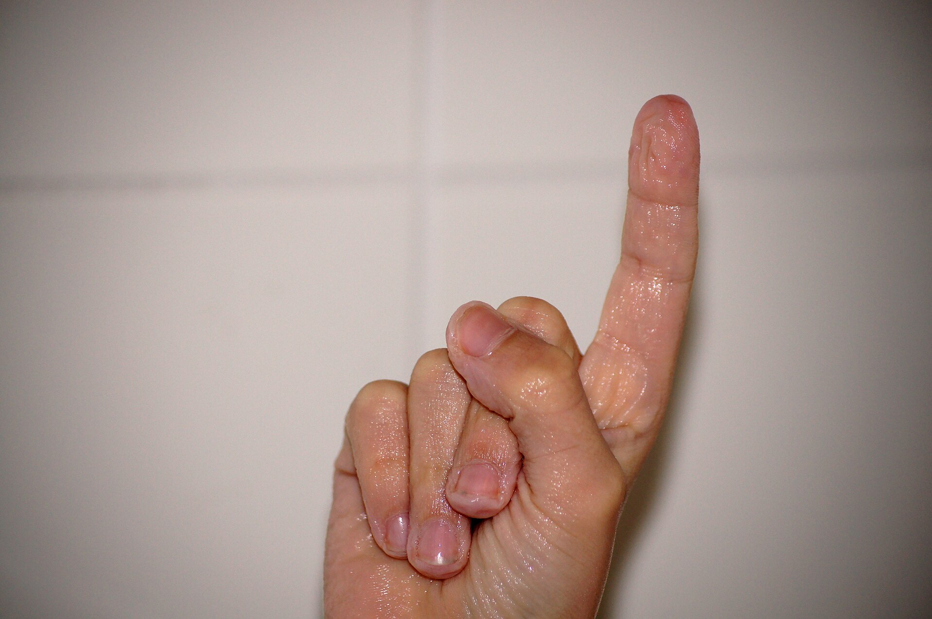 Wrinkled fingertips after soaking in water