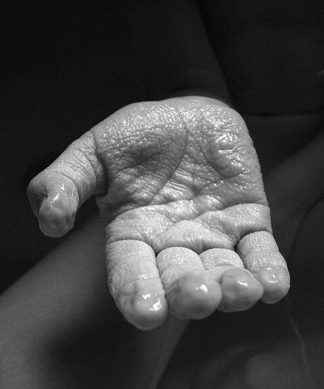 A close view of a hand with deeply wrinkled, water-soaked skin