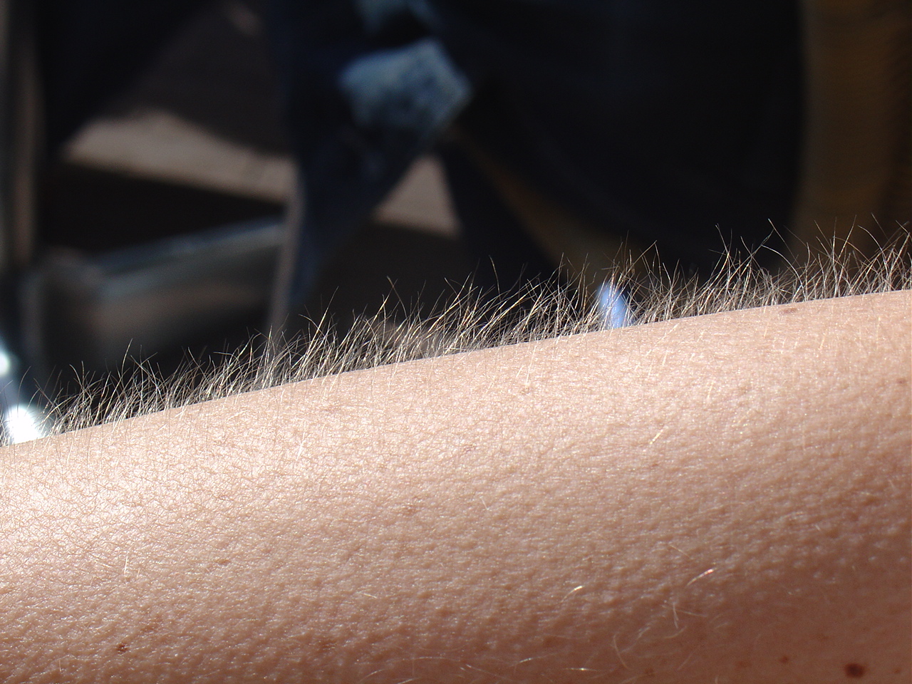 Raised hairs and bumpy skin: goosebumps on a human arm