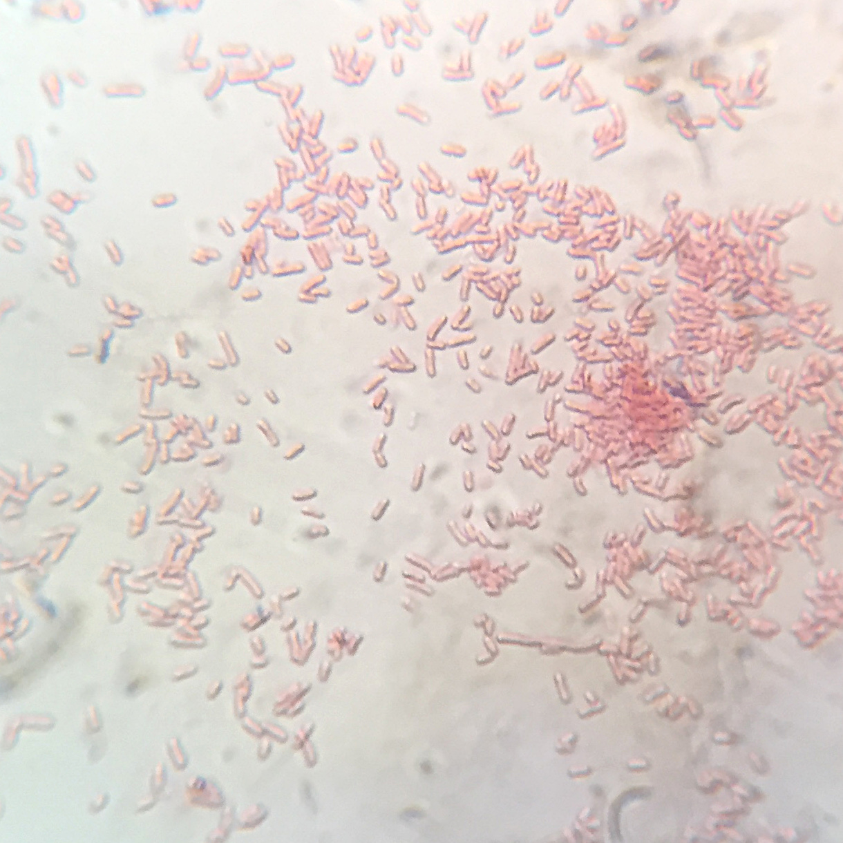 Shigella bacteria seen under a microscope on a glass slide