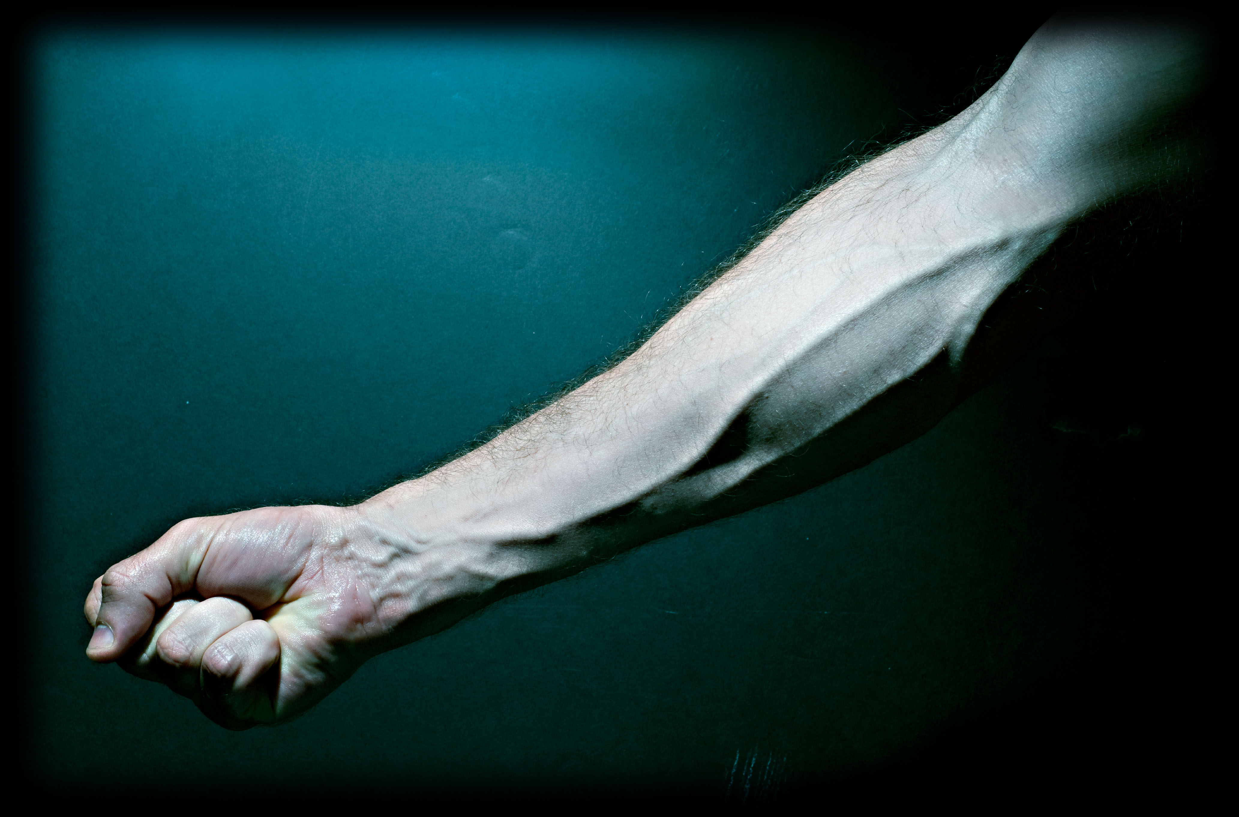 Close-up photograph of pronounced veins on a person's forearm