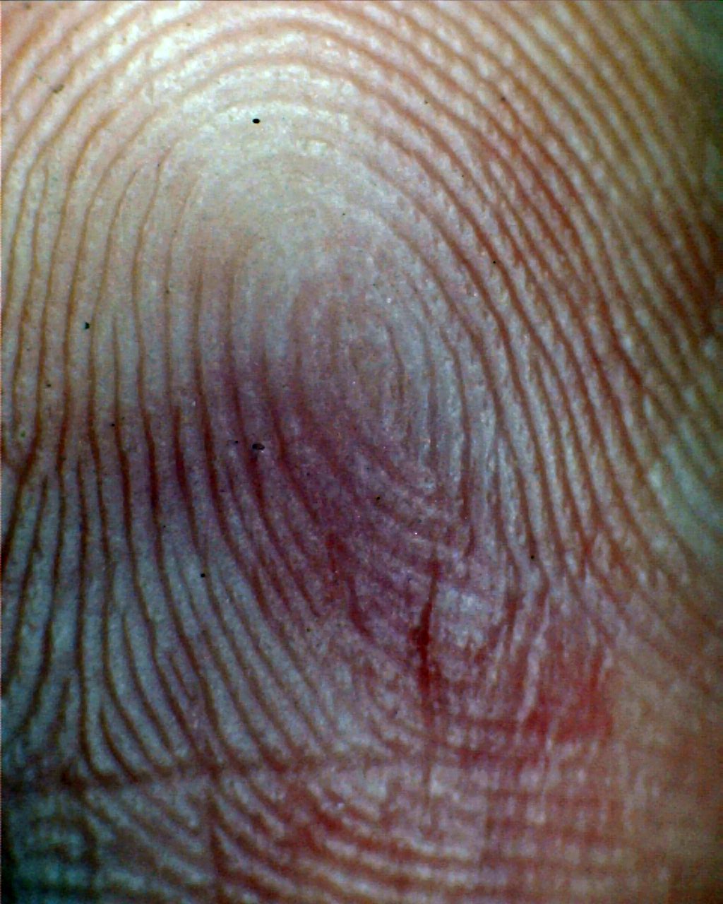 A fingerprint with a central pocket loop whorl pattern