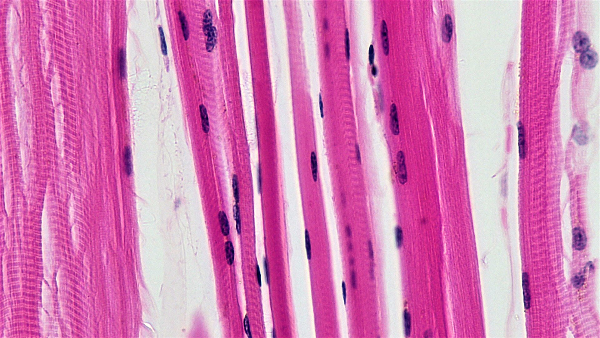Skeletal muscle tissue seen under a microscope