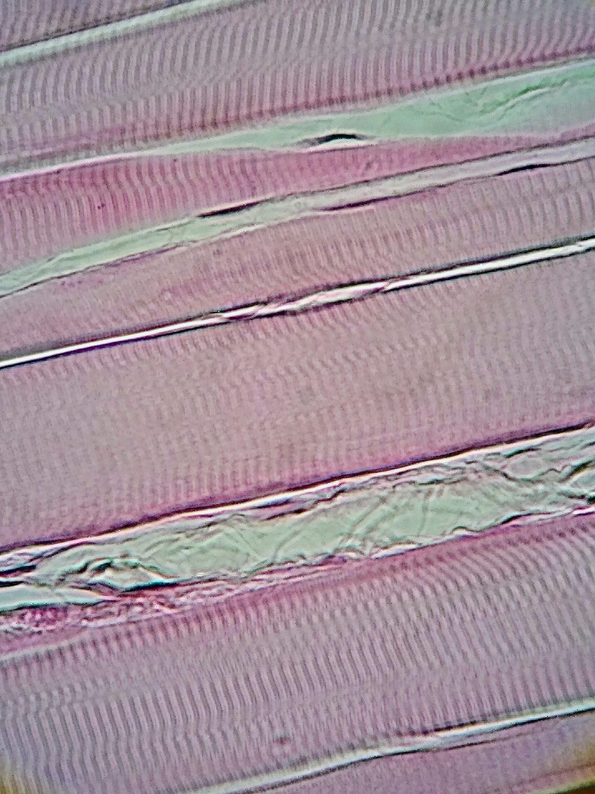 Skeletal muscle fibers at 400x magnification