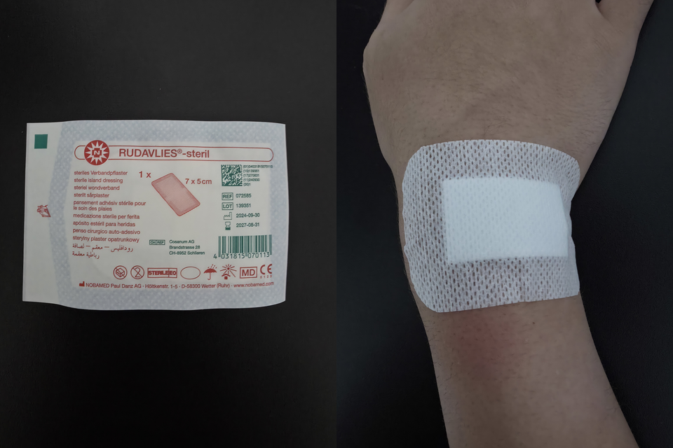 An adhesive dressing shown in its packaging and applied to a patient