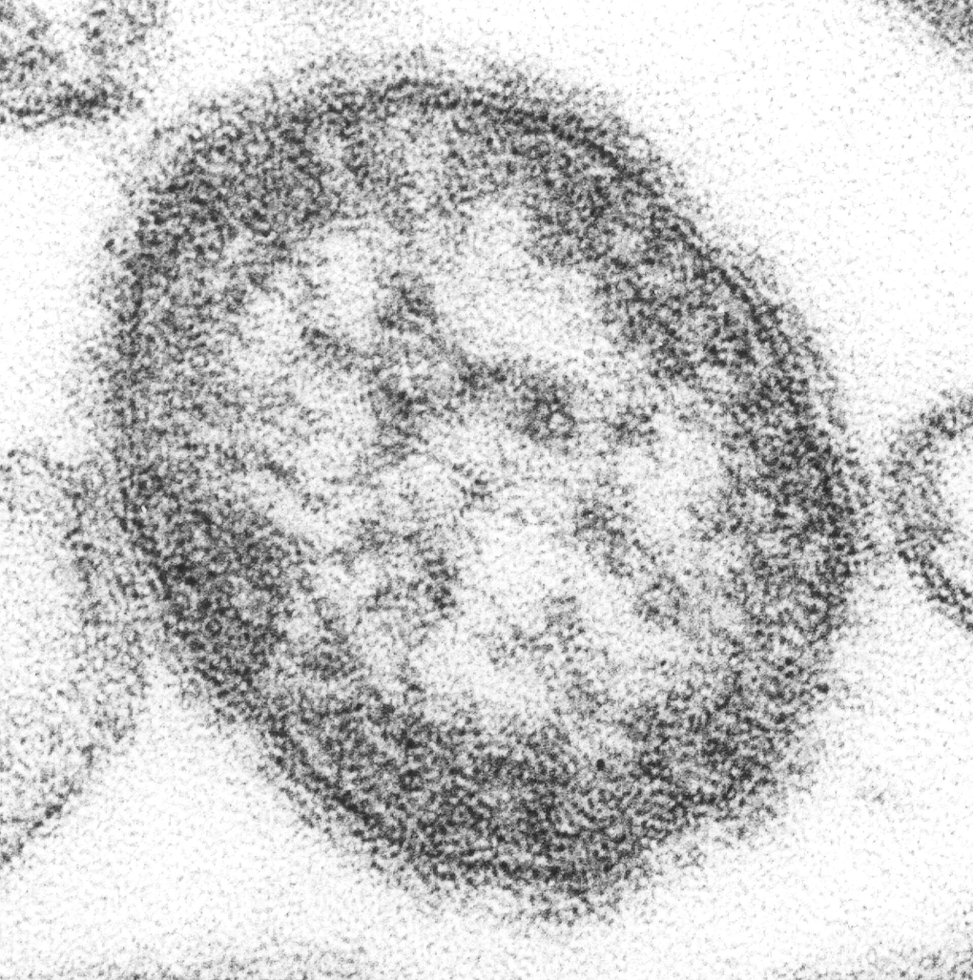 Microscope view of a single measles virus particle