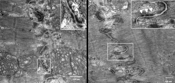 Electron microscopy of the junction between two heart muscle cells