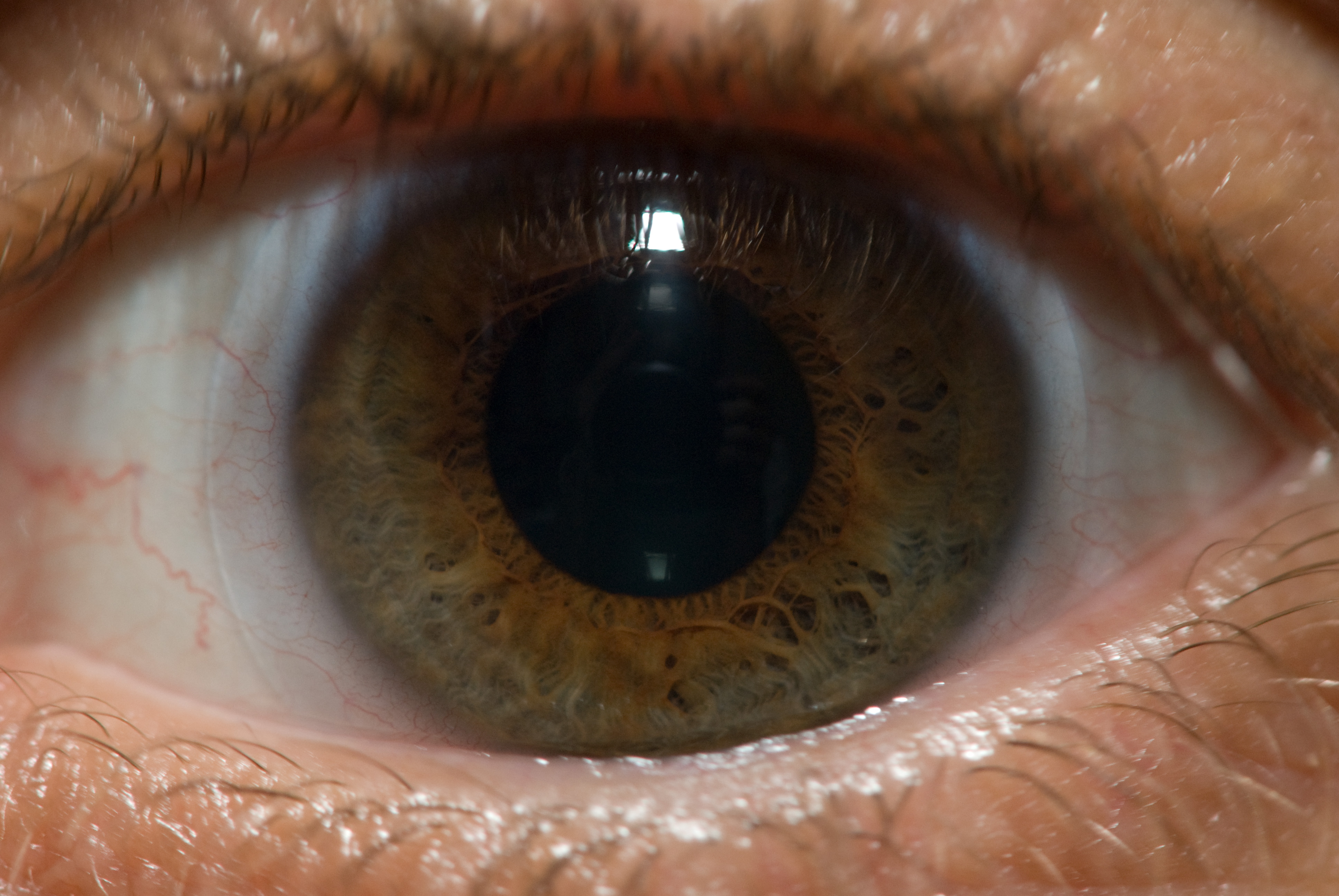 A close-up of a human eye showing the iris