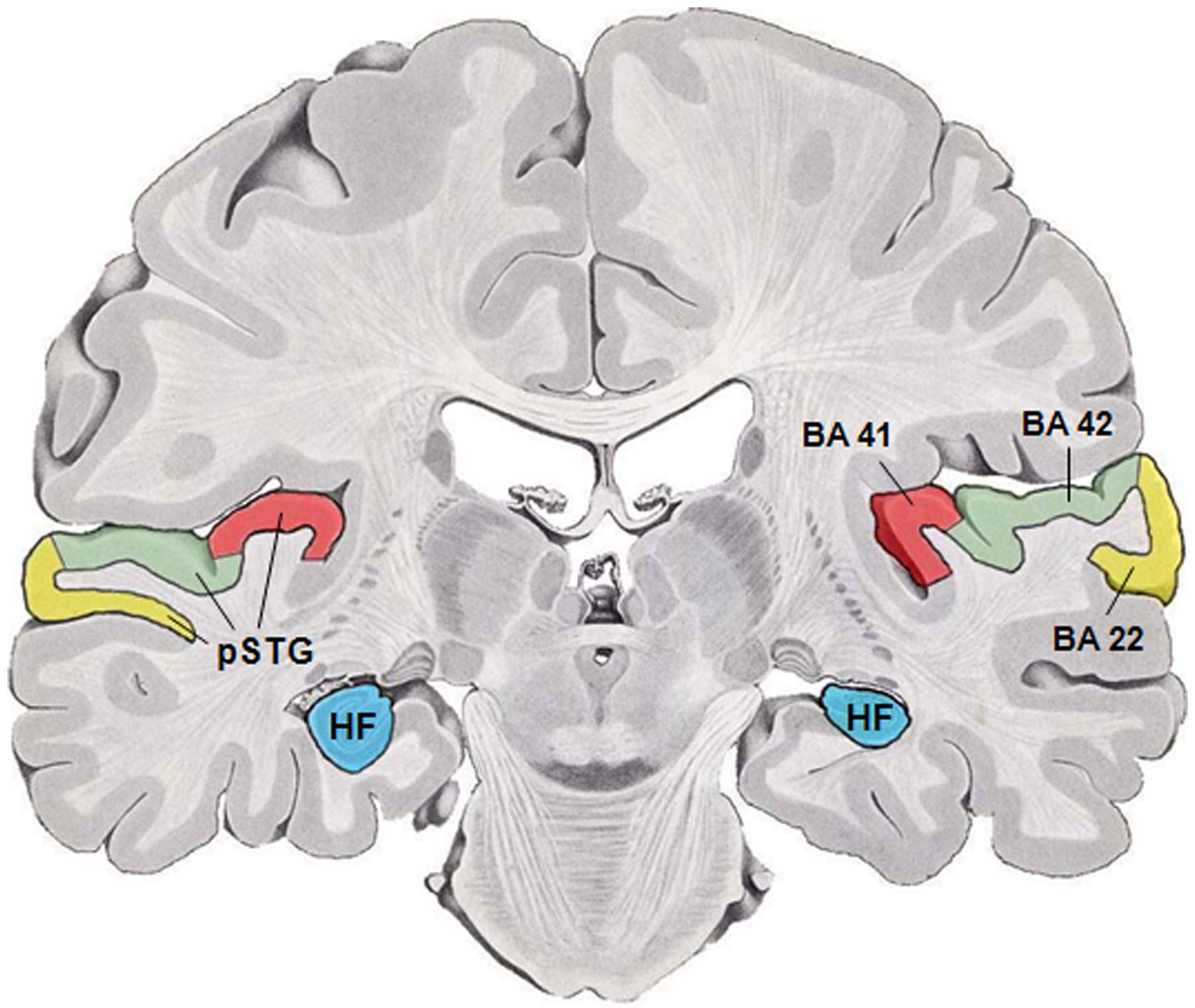 Illustration of a human brain with the temporal lobe region highlighted