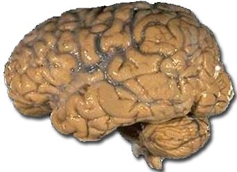 A diagram of a human brain from the National Institutes of Health